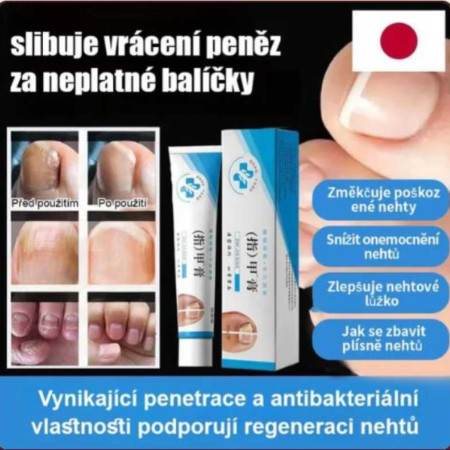 Nail treatment cream — ফাঙ্গাস, পুঁজ ও রক্ত পড়া সহ নখের সমস্যায় কার্যকর ক্রিম (২০ গ্রাম)